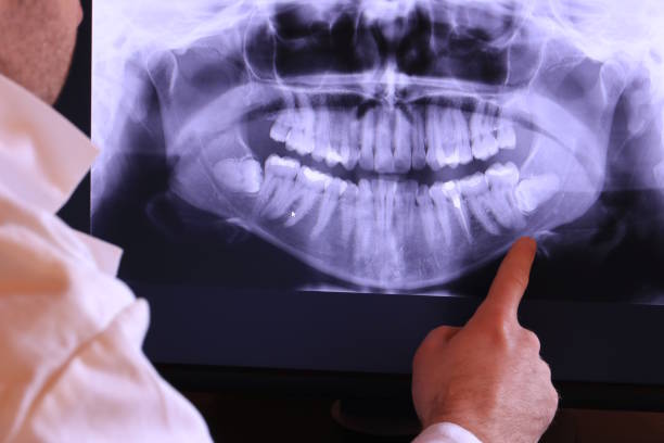 Best Emergency Dental Extractions in North Lauderdale, FL