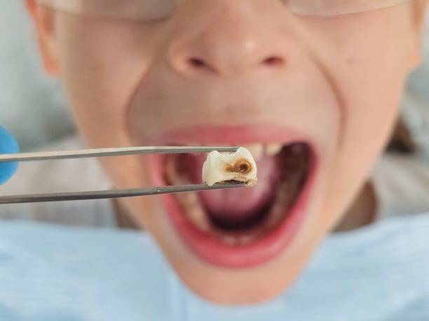 Best Pediatric Emergency Dentist in North Lauderdale, FL